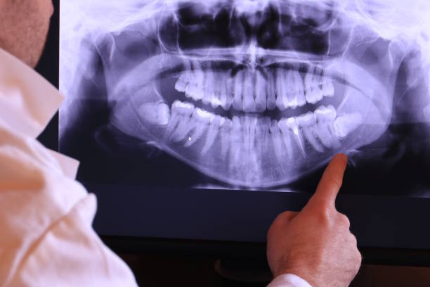 Best Tooth Pain Emergency Relief  in Ocean Shores, WA